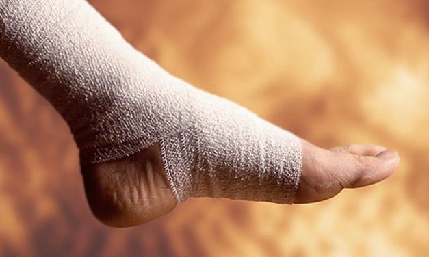 Topical Wound Oxygen Therapy Helps Heal Diabetic Foot Ulcers
