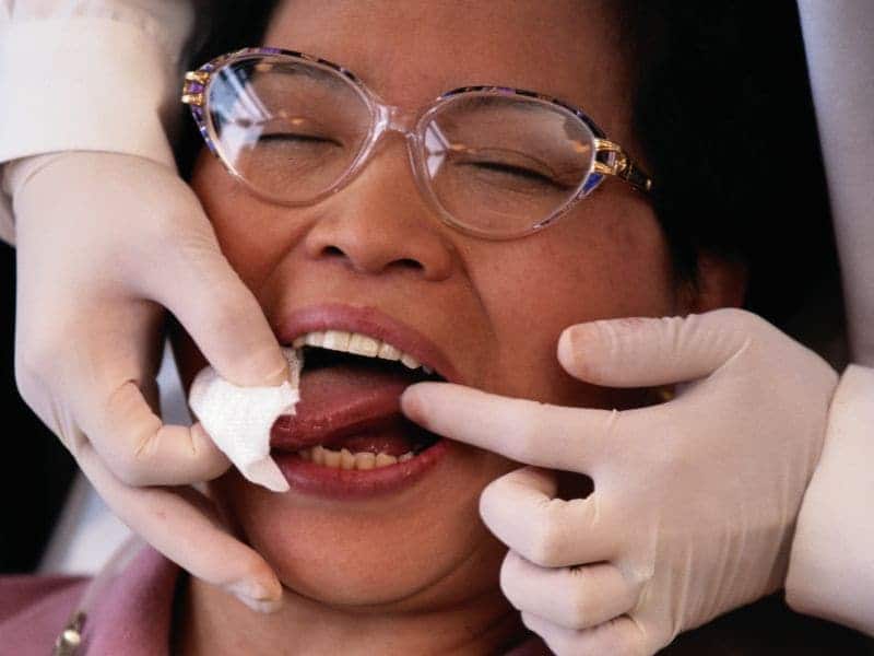 Minority, Low-Income Individuals Less Likely to Receive Oral Cancer Screening