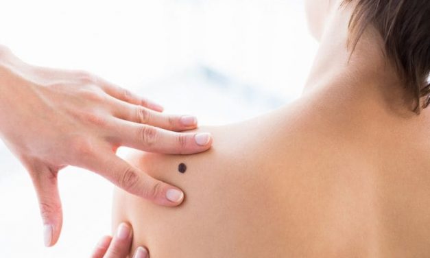 Patients With Melanoma In Situ Have Increased, But Low, Risk for Mortality