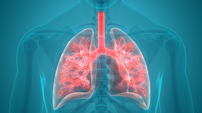 Pulmonary Involvement in Patients with VEXAS Syndrome