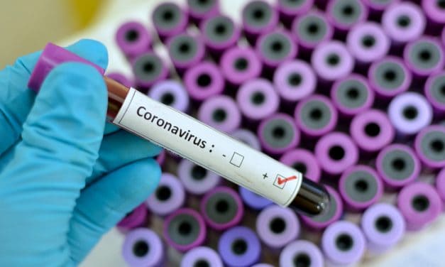 Pharma firm Anges and Osaka University to begin testing coronavirus vaccine on animals
