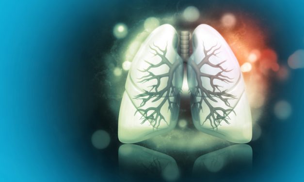 Add-on Tiragolumab Doesn’t Improve on Atezolizumab in Extensive Stage Small Cell Lung Cancer