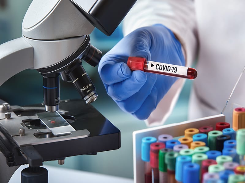 Antibody Tests ID COVID-19 Two to Three Weeks After Symptoms