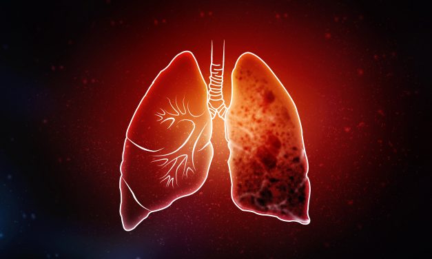The Link Between Diabetes and Idiopathic Pulmonary Fibrosis