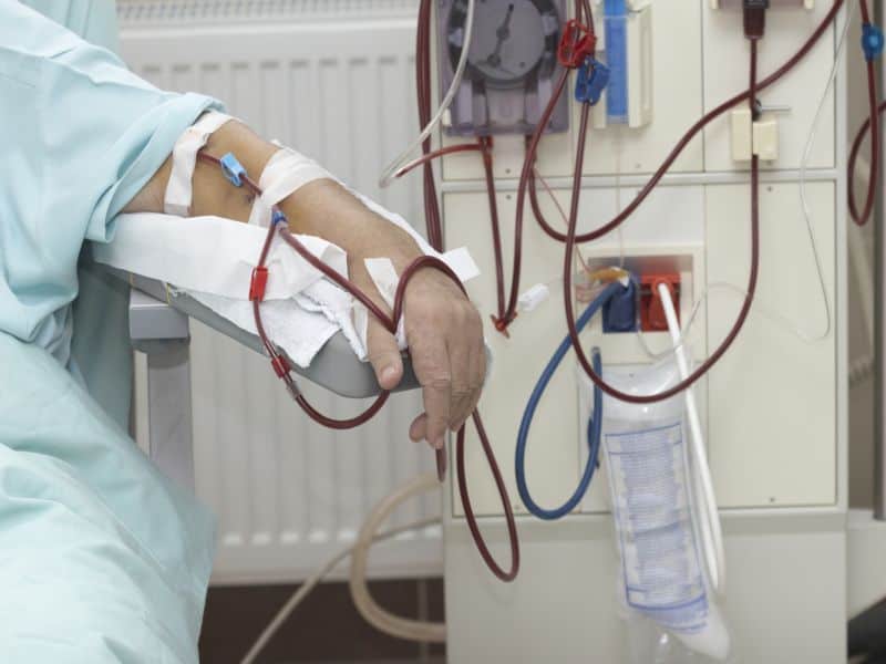Maintenance Dialysis Patients and Cigarette Smoking