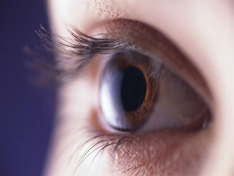 Pupillary Light Reflex Metrics May ID Sports Concussion in Teens