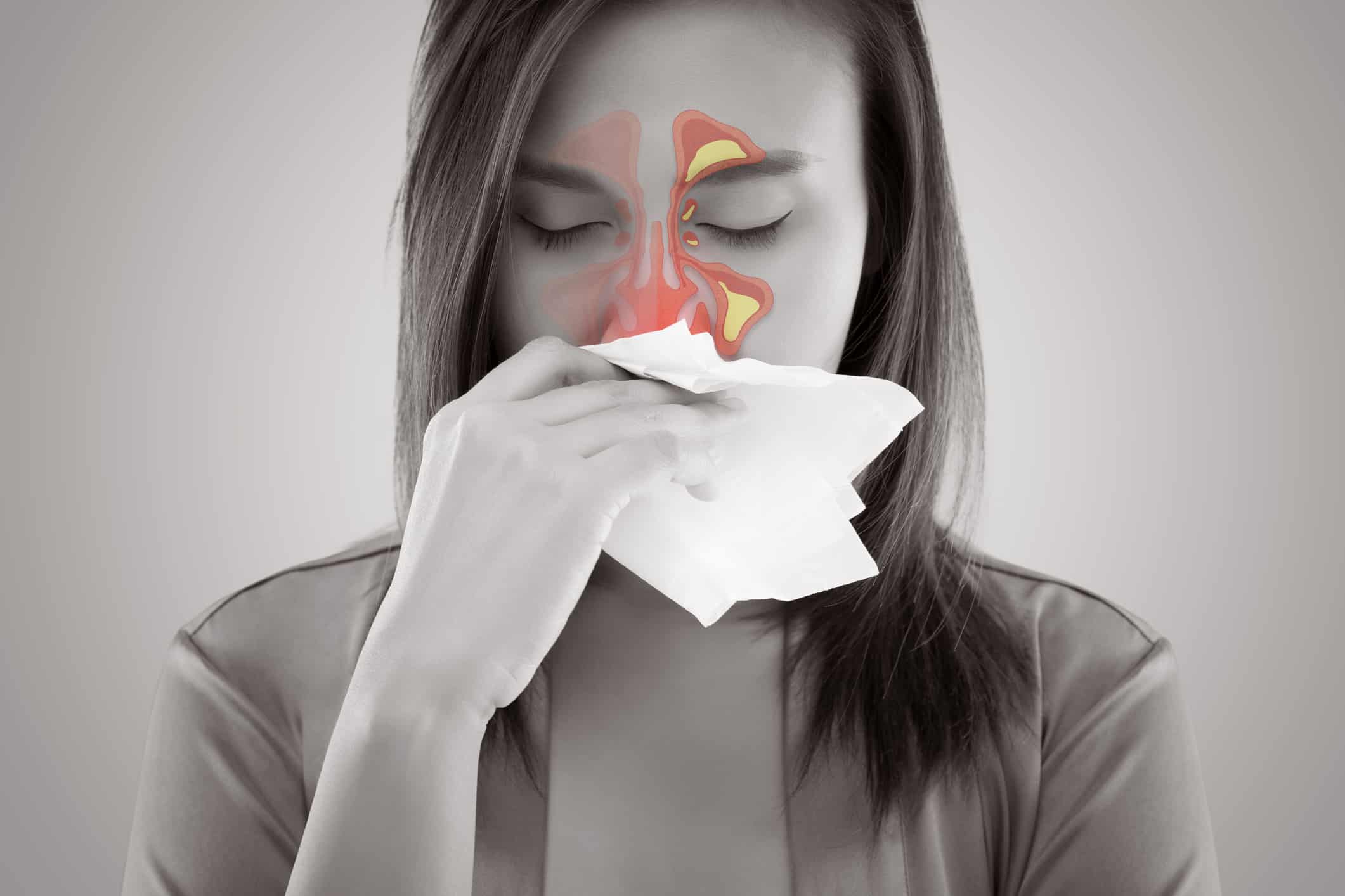 A Novel Patient-Reported Outcome Measure for Chronic Rhinosinusitis
