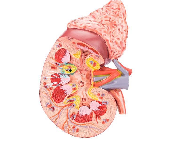 Removal Plus Transplant Surgery Feasible in Polycystic Kidney Disease