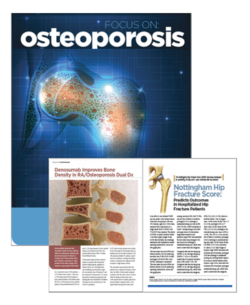 In Focus: Osteoporosis eBook