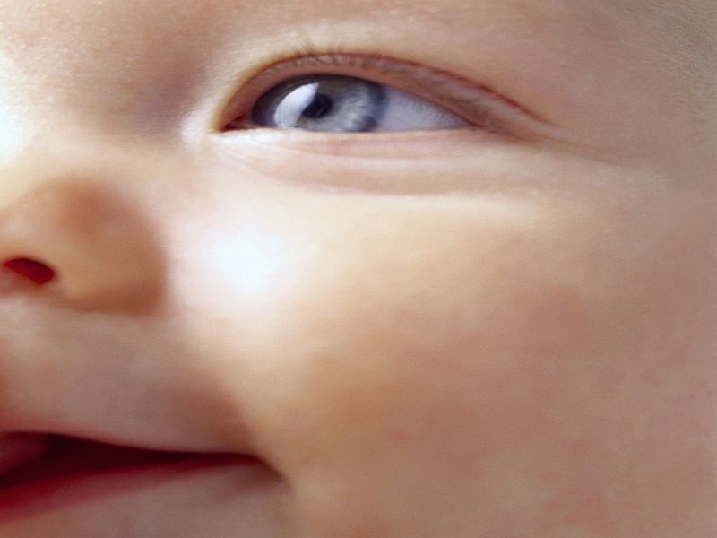 Risk for Glaucoma Up After Cataract Removal in Infancy
