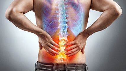 Bone Quality Linked to Complications After Spinal Fusion