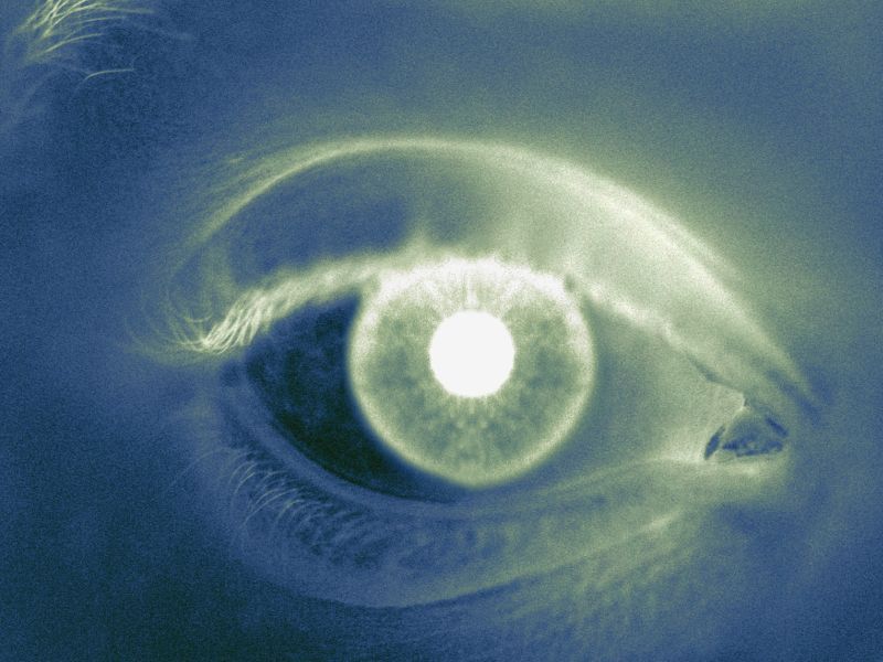 Eye Abnormalities Identified in Severe COVID-19 Patients