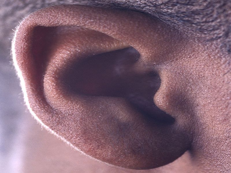 USPSTF: Evidence Lacking for Screening Seniors for Hearing Loss