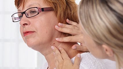 Actinic Keratosis Diagnosis Ups Cumulative Risk for Skin Cancer