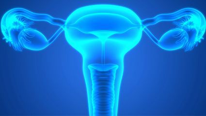 Carboplatin Alone Not Adequate for Ovarian Cancer in Frail Seniors
