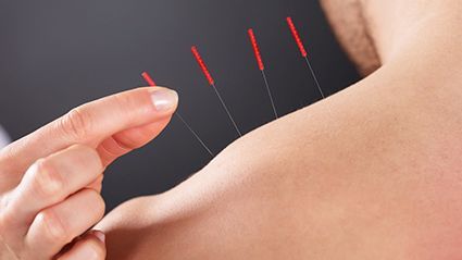 Acupuncture Effective for Chronic Muscular Pain in Cancer Survivors