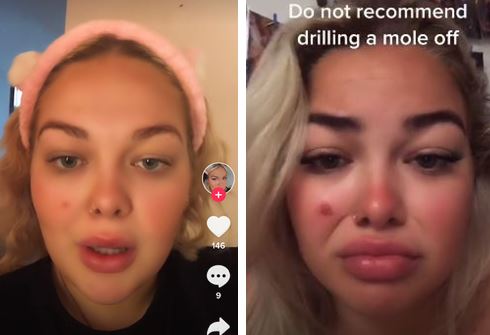 A TikTok challenge: Can it be stopped from harming people?