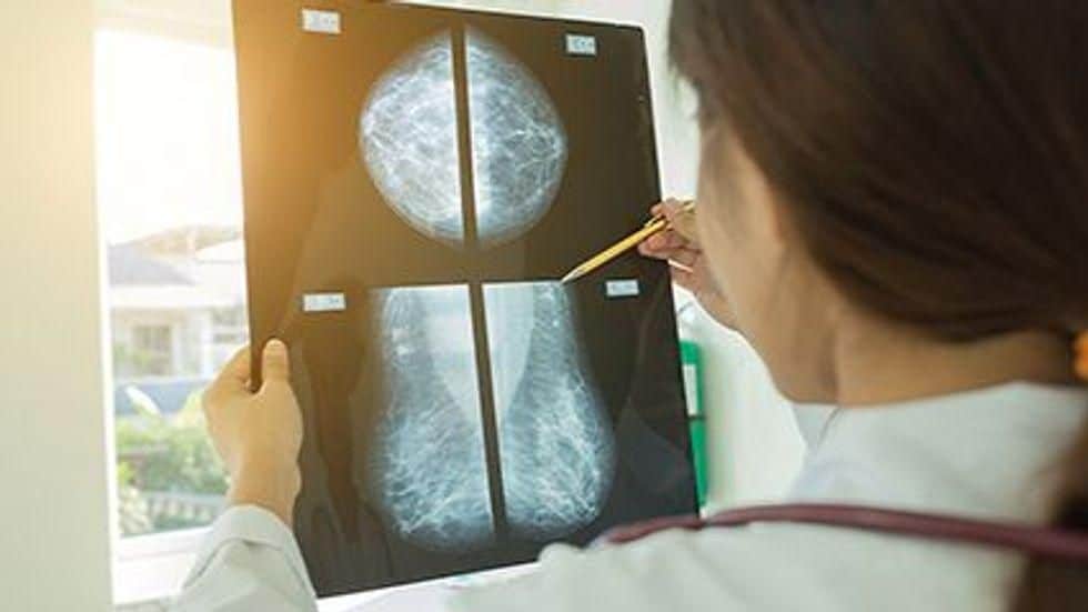 Black Patients More Likely to Die From Triple-Negative Breast Cancer
