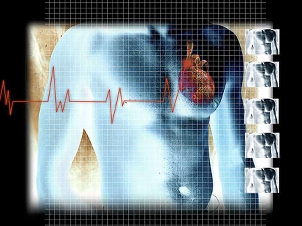 AI Algorithm Aids Early Detection of Low Ejection Fraction
