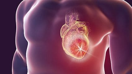 Impaired First-Phase Ejection Fraction Tied to COVID-19 Mortality