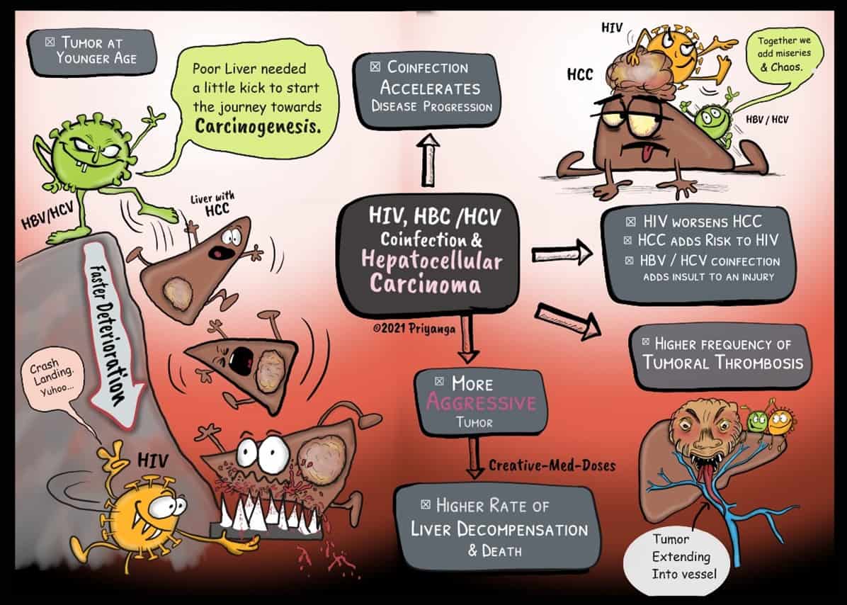 Hepatocellular Carcinoma & HIV