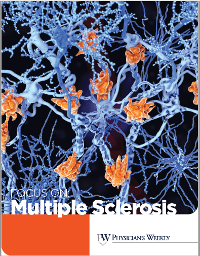 A Focus on Multiple Sclerosis – eBook
