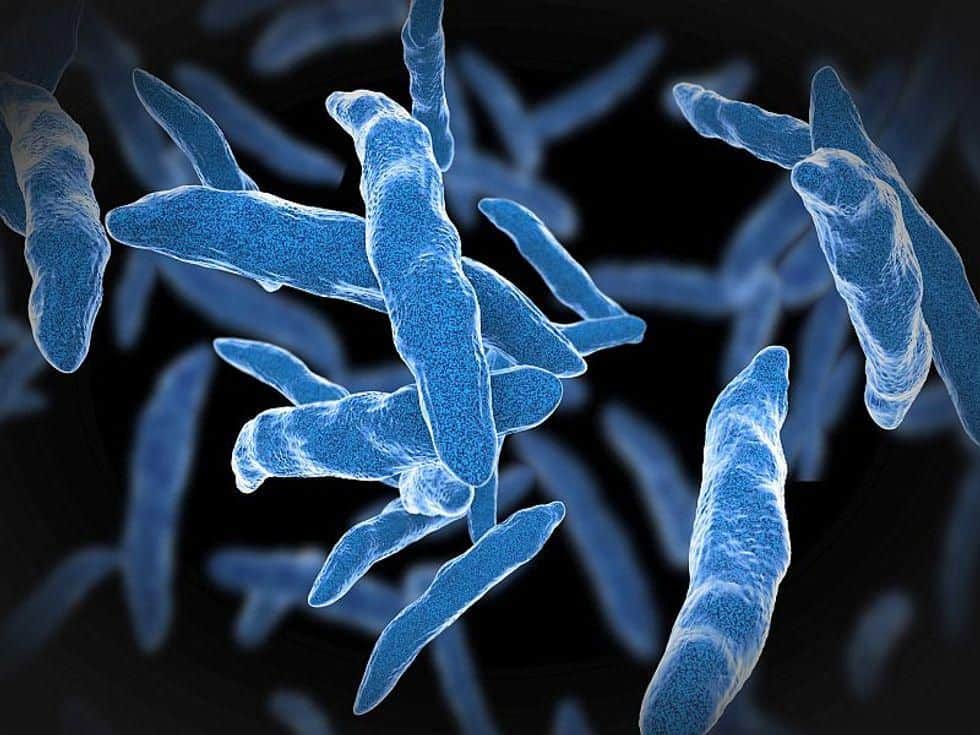 TB Outbreak May Be Linked to Bone Repair Product