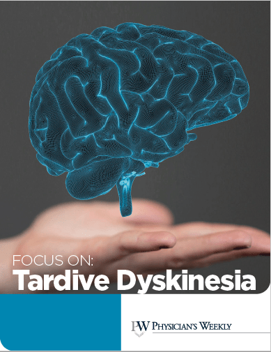 A Focus on Tardive Dsykinesia – eBook