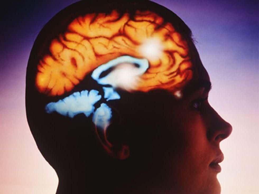 Cognitive, Functional Decline Detected Prior to Stroke