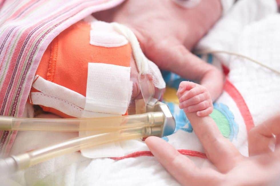25 Weeks May Be Cutoff for Severe Neurological Outcomes in Preemies