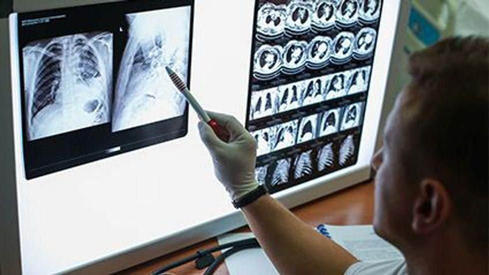 Lung Cancer Screening Rates Mainly Unchanged During Pandemic