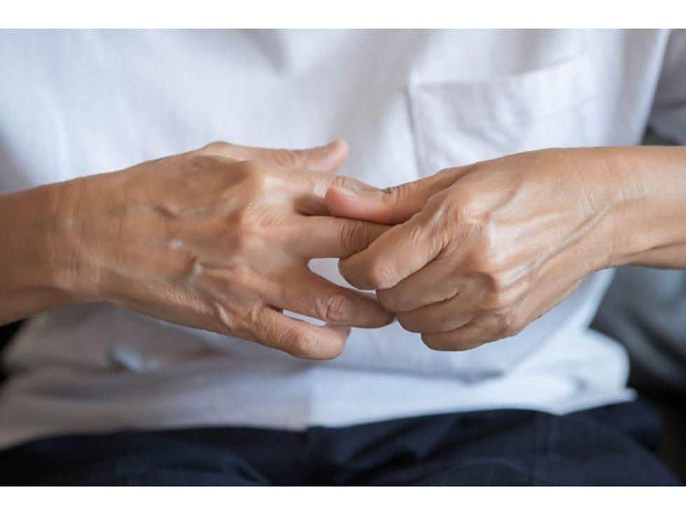 Psoriatic Arthritis Worsens QoL in Patients With Psoriasis