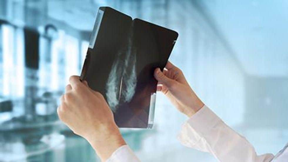 Breast Cancer Screening Down Among Low-Income Women During Pandemic