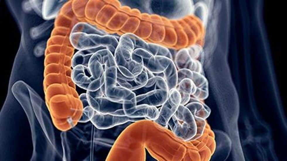 Very High Antibiotic Use May Up Risk for Proximal Colon Cancer
