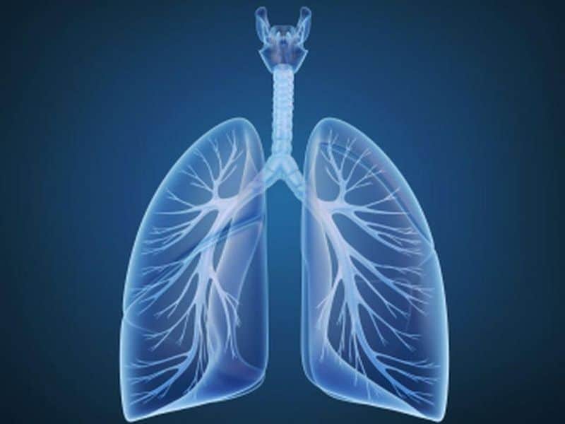 Artificial Intelligence May Speed Lung Cancer Detection