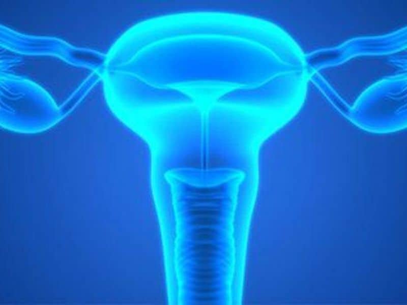 Health Care Costs for Polycystic Ovary Syndrome High in the U.S.