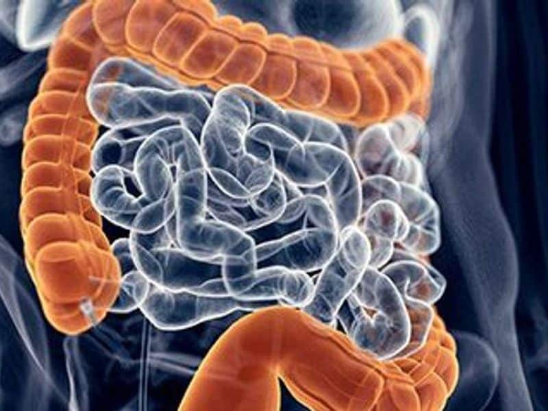 Sulfur Microbial Diet May Increase Risk for Colorectal Cancer
