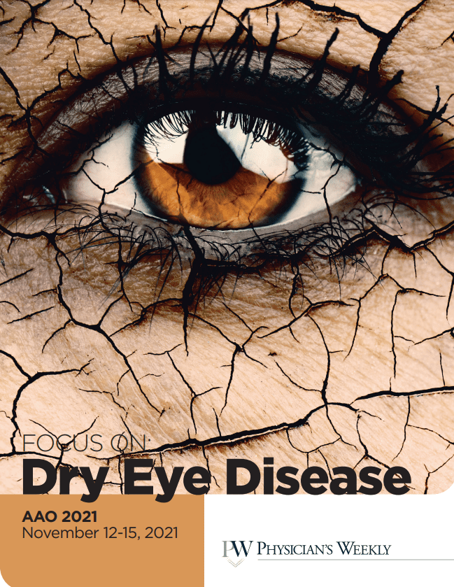 AAO 2021: A Focus on Dry Eye Disease eBook