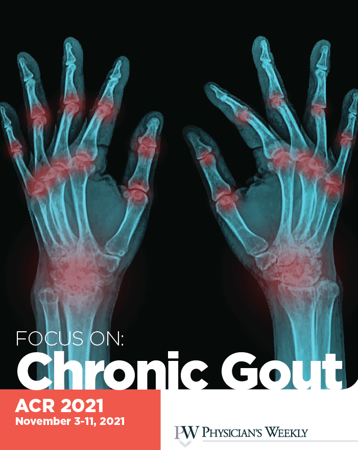 ACR 2021: A Focus on Chronic Gout eBook