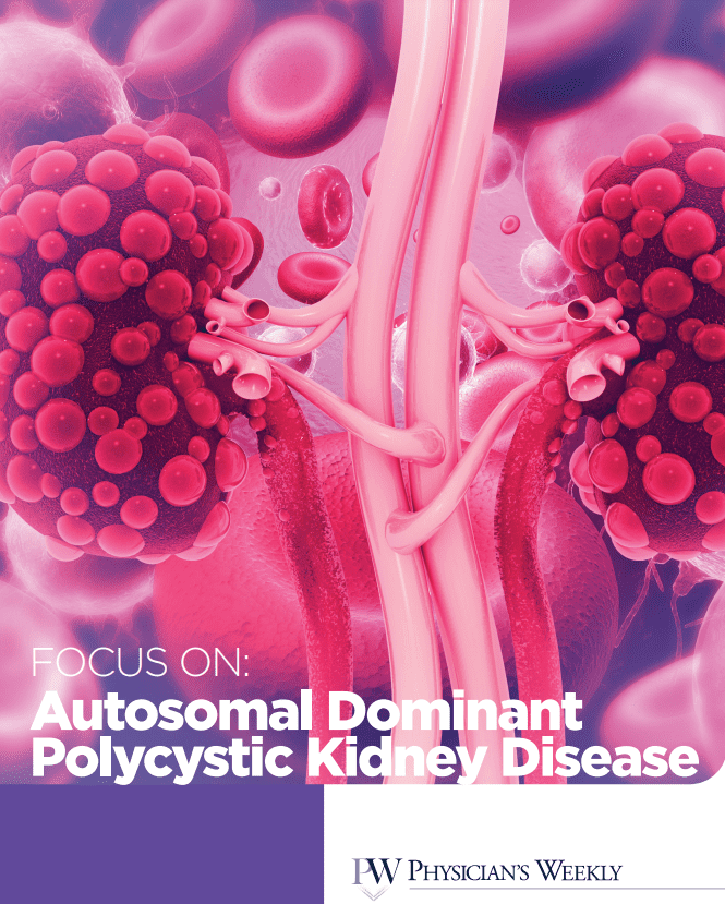 Focus on Autosomal Dominant Polycystic Kidney Disease (ADPKD) eBook