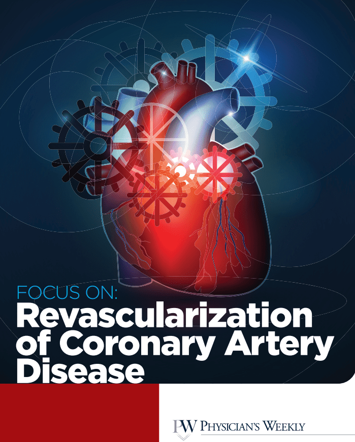 A Focus on Coronary Artery Disease eBook