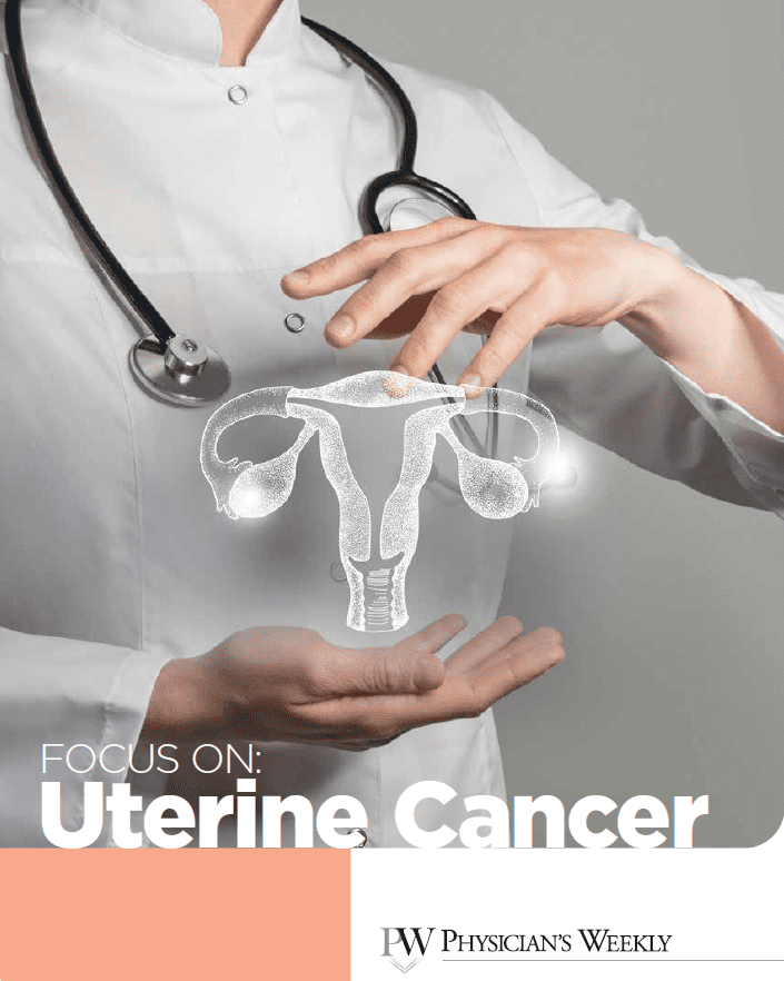 A Focus on Uterine Cancer eBook
