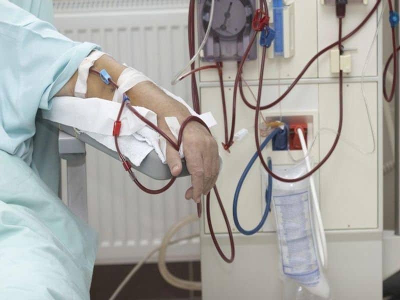 Antibody Response to SARS-CoV-2 Wanes Among Dialysis Patients