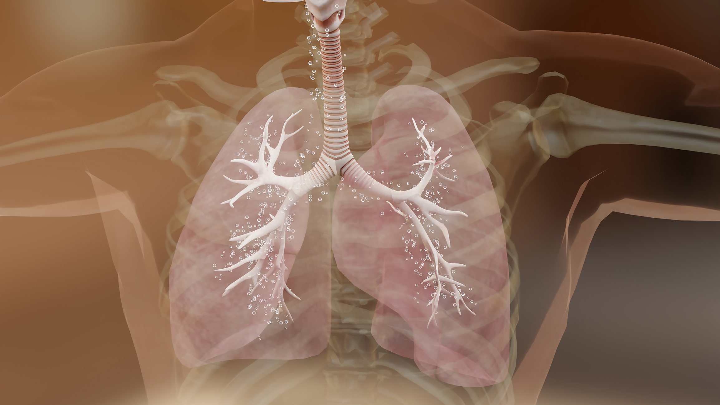 Circulating Tumor DNA IDs Relapse Risk in Early NSCLC