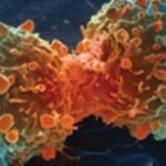 Abemaciclib linked to disease control in patients with p16ink4A-negative mesothelioma