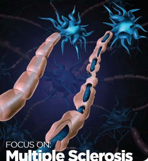 Focus on Multiple Sclerosis Ebook