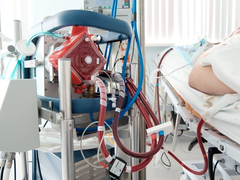 Survival High With ECMO for Selected Severe COVID-19 Patients