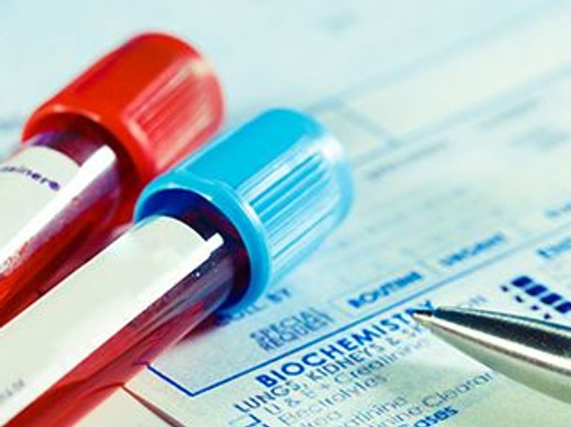 Cardiac Biomarkers and CV Risk Examined in Psoriatic Disease