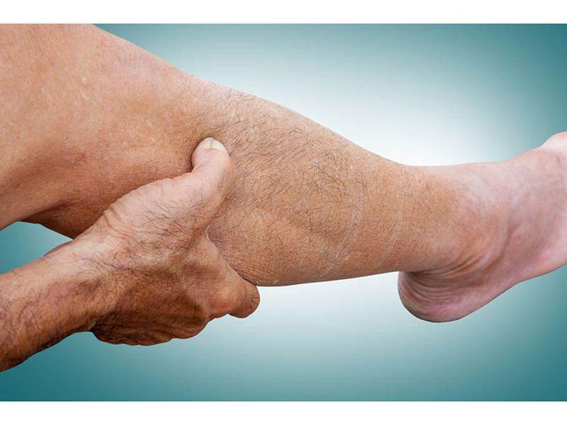 Peripheral Neuropathy Observed in Patients With ‘Long COVID’