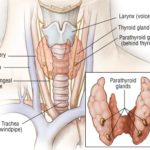 Postoperative treatment without radioiodine has noninferior outcomes following thyroidectomy